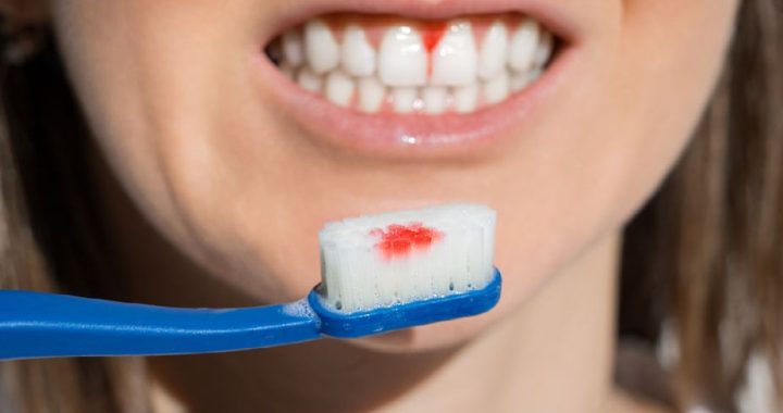 YOTUEL microbiome toothpaste, sensitive whitening toothpastes